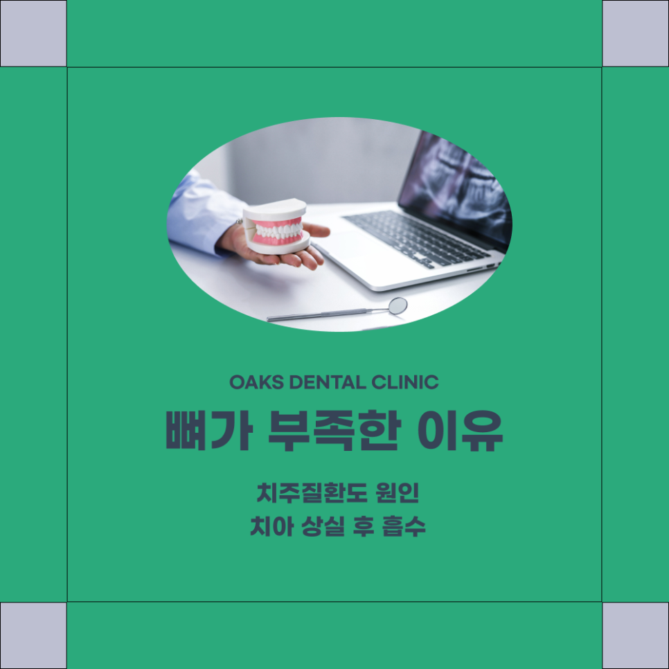 신사동치과 임플란트뼈이식 필요한 이유와 치료 전 확인해야 할 사항 관련 이미지 2