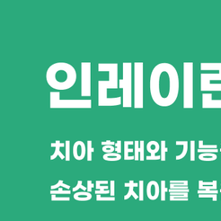 Minimize Tooth Damage and Restore a Natural Appearance with Inlay Treatment at a Samsung-dong Dental Clinic image 8