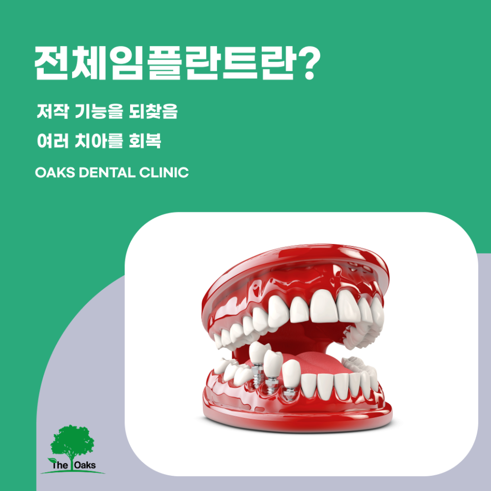 세곡동치과 전체임플란트 어떤 경우에 필요할까요? 관련 이미지 1