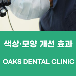 강남치과 라이네이트 장단점 알아보자 관련 이미지 15