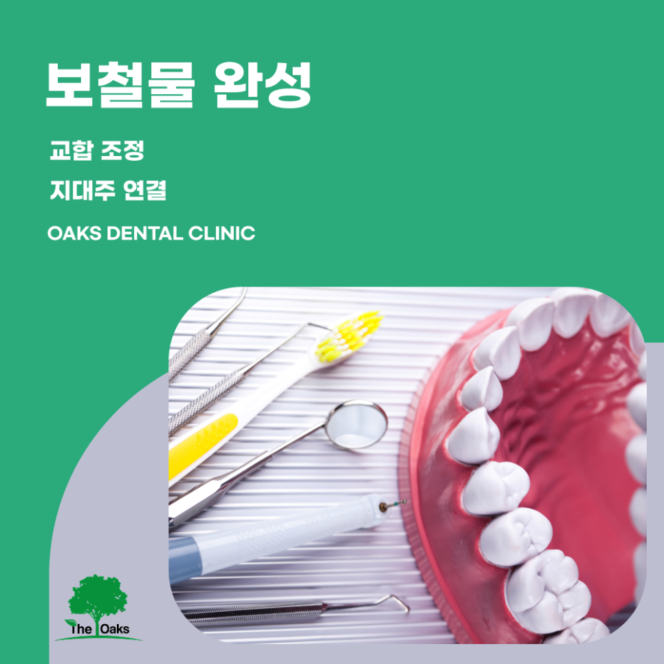 자곡동치과 임플란트과정 처음부터 마지막까지 꼼꼼하게 알아보자 관련 이미지 5