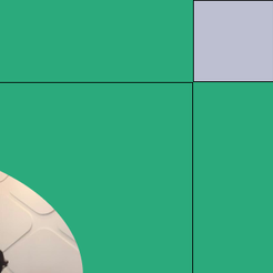 도곡동치과 임플란트기간 얼마나 걸릴까 단계별 과정부터 회복까지 안내 관련 이미지 10