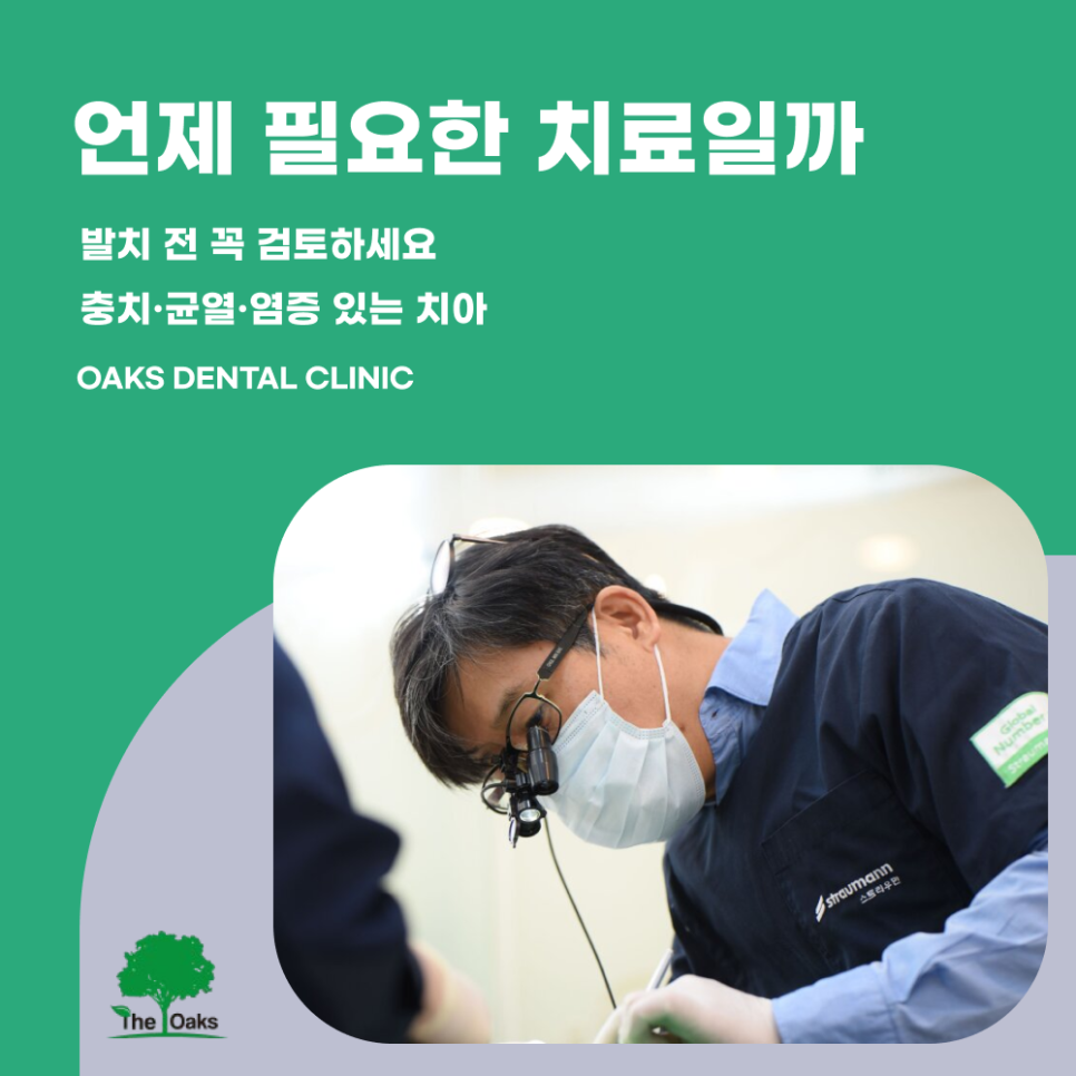 세곡동치과 치아보존치료란 자연치아를 살리는 선택 관련 이미지 3