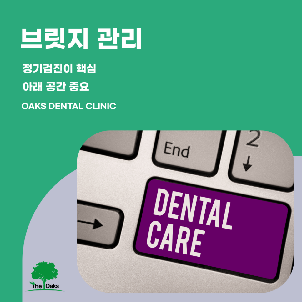 대치동치과 치아브릿지 어떤 상황에 도움될까 관련 이미지 5