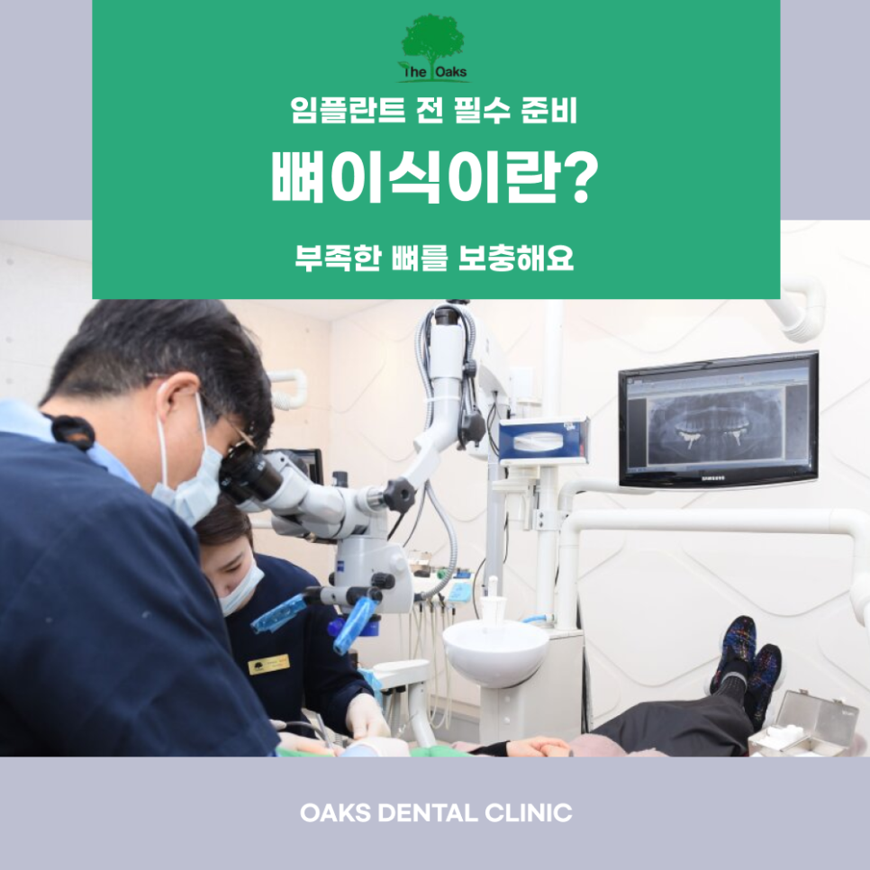 삼성동치과 임플란트뼈이식 꼭 필요한 이유 관련 이미지 1