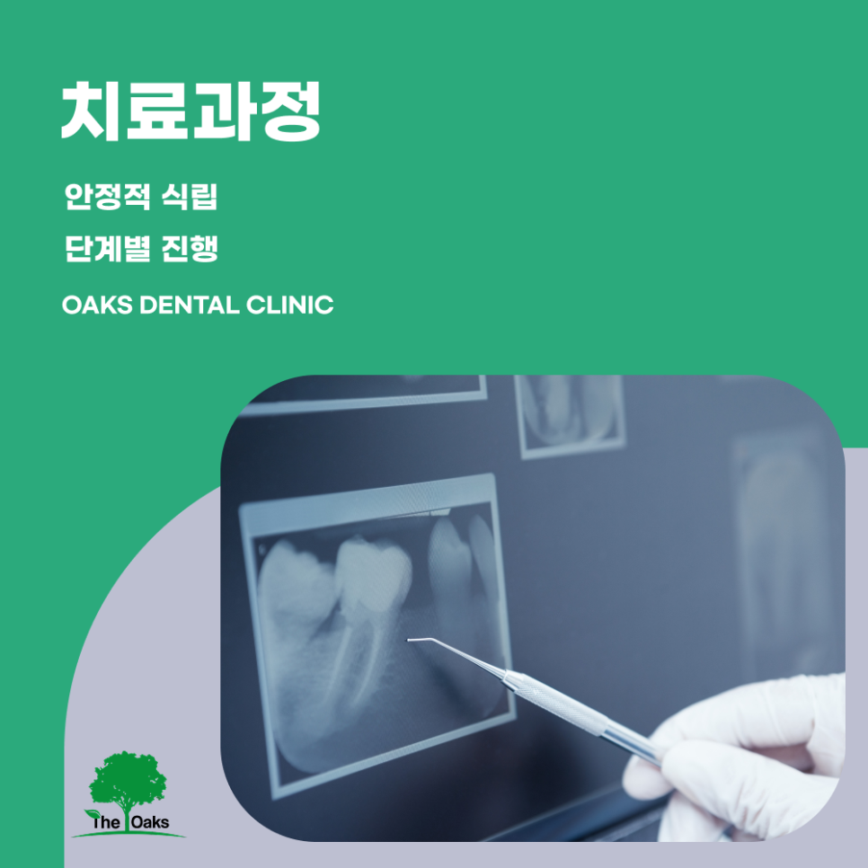 세곡동치과 뼈이식임플란트 부족한 잇몸뼈를 보완해 성공률을 높이는 방법 관련 이미지 4