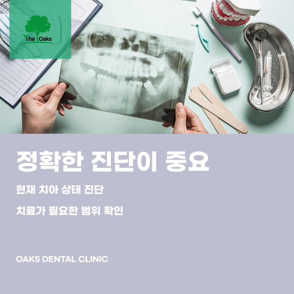 역삼동치과 치아신경치료비용 왜 차이가 있을까요? 관련 이미지 4