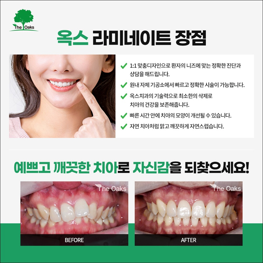 신논현치과 치아 건강을 위하여 관련 이미지 11