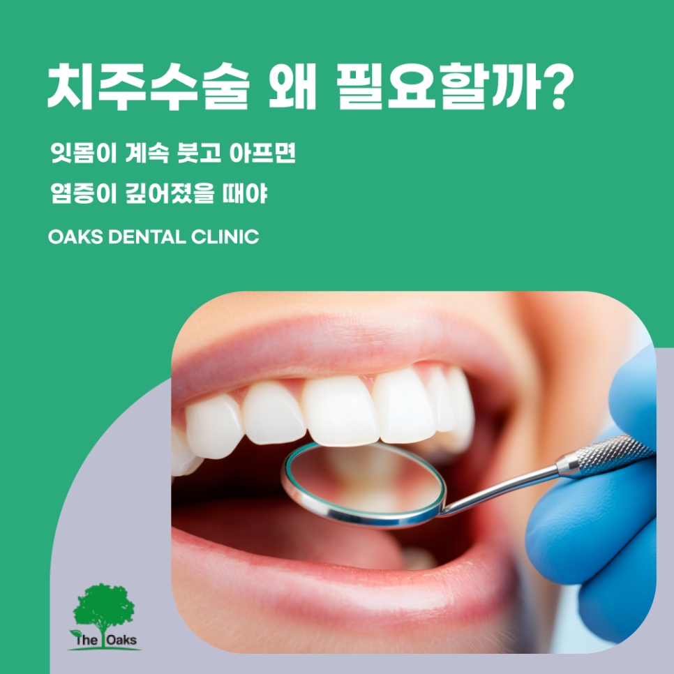 도곡동치과 치주수술 자연치아를 지키는 선택 관련 이미지 2