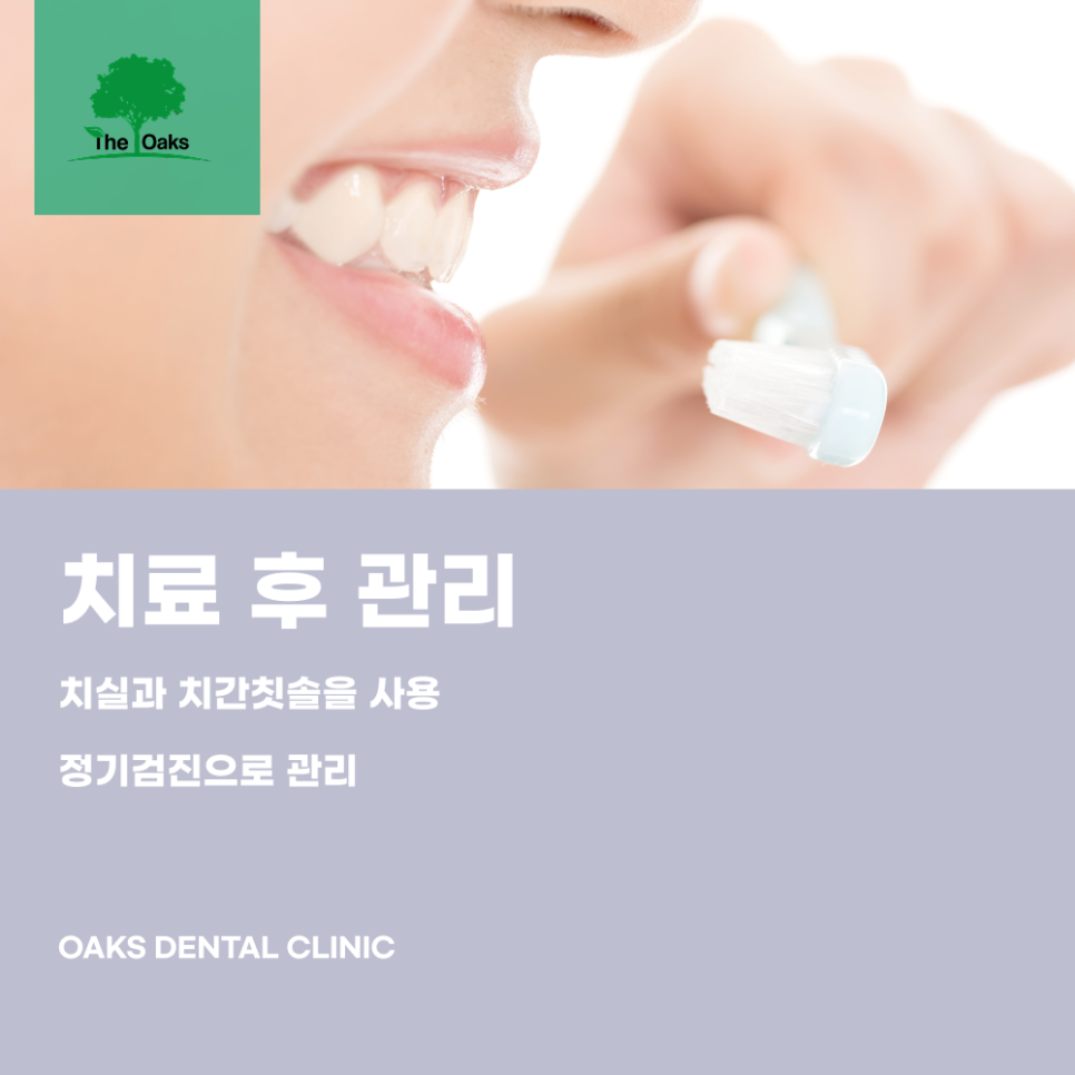 삼성동치과 앞니임플란트 자연스러운 결과를 위해 중요한 것 관련 이미지 5