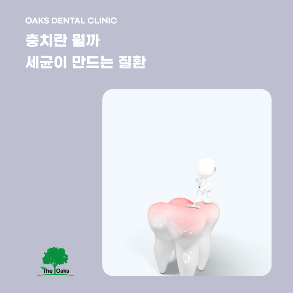Gangnam-gu Dental Clinic: Why Even Small Cavities Should Not Be Left Untreated image 1
