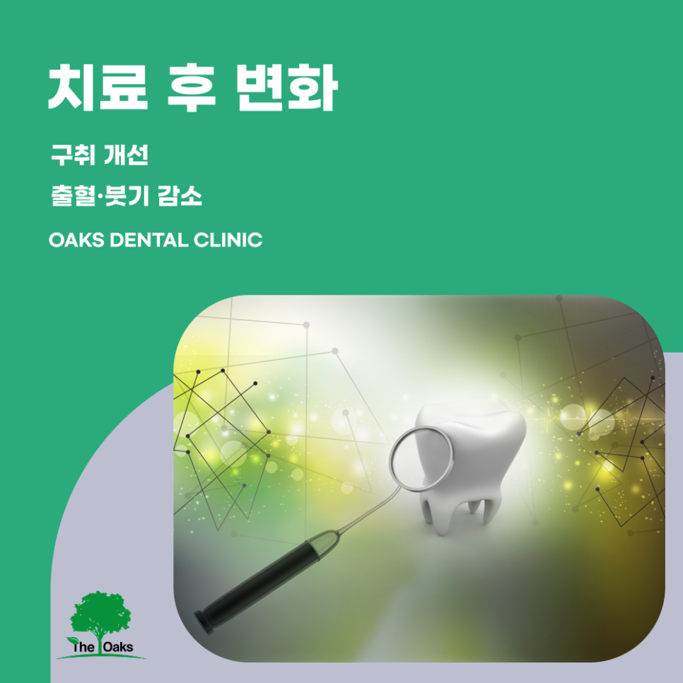 강남구치과 잇몸치료 치아를 오래 지키는 가장 기본적인 치료 관련 이미지 4