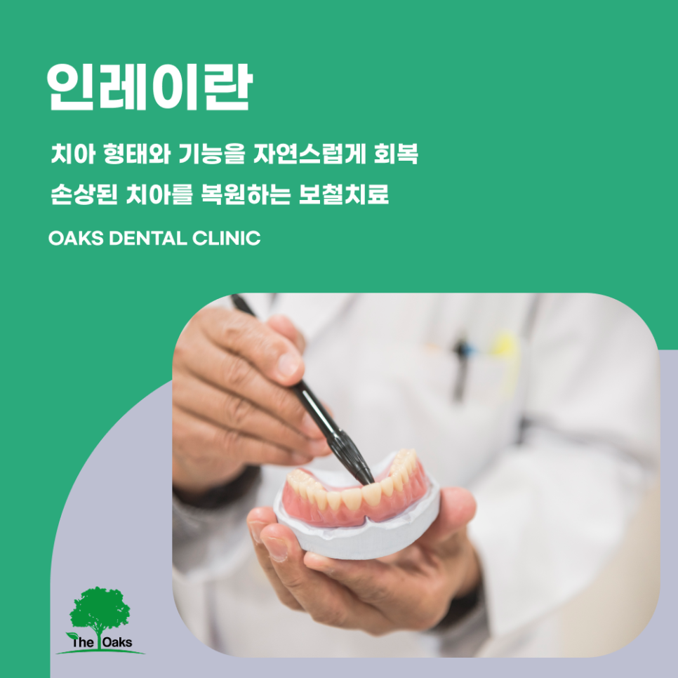Minimize Tooth Damage and Restore a Natural Appearance with Inlay Treatment at a Samsung-dong Dental Clinic image 1
