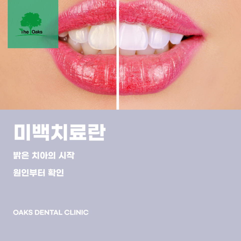 Choosing a Gangnam Station Teeth Whitening Dental Clinic for a Natural Smile image 1