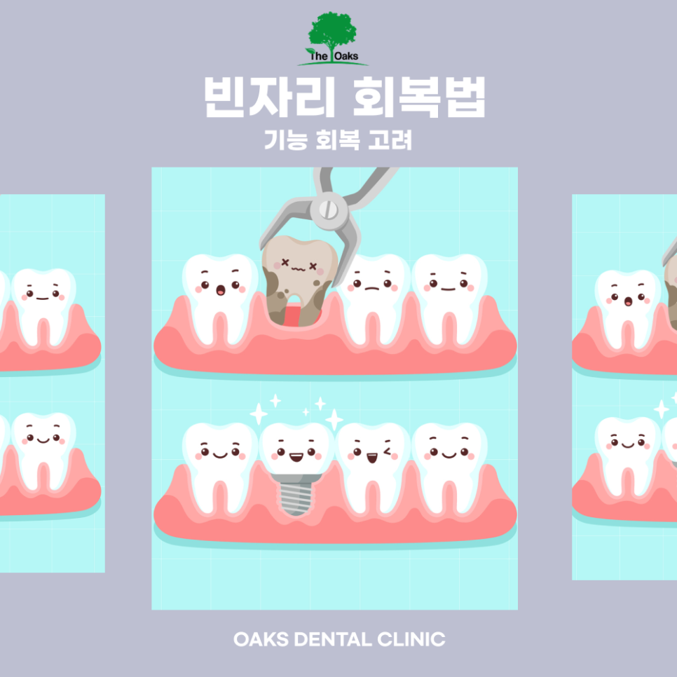 교대역치과 발치 꼭 필요한 경우와 치료 후 관리까지 관련 이미지 5