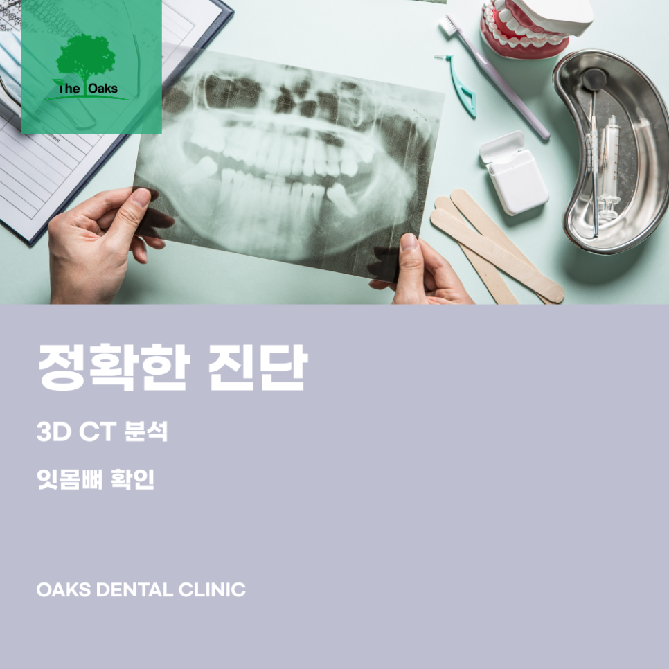 자곡동치과 임플란트과정 처음부터 마지막까지 꼼꼼하게 알아보자 관련 이미지 1
