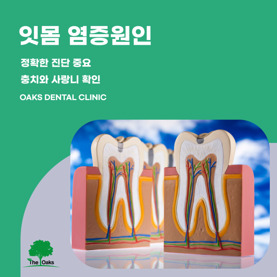 도곡동치과 잇몸부었을때 방치하지 말아야 하는 이유 관련 이미지 2