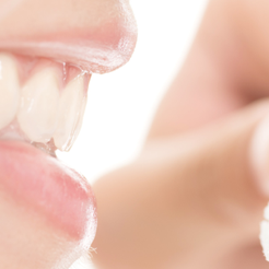 Gangnam-gu Dental Clinic: Why Even Small Cavities Should Not Be Left Untreated image 9