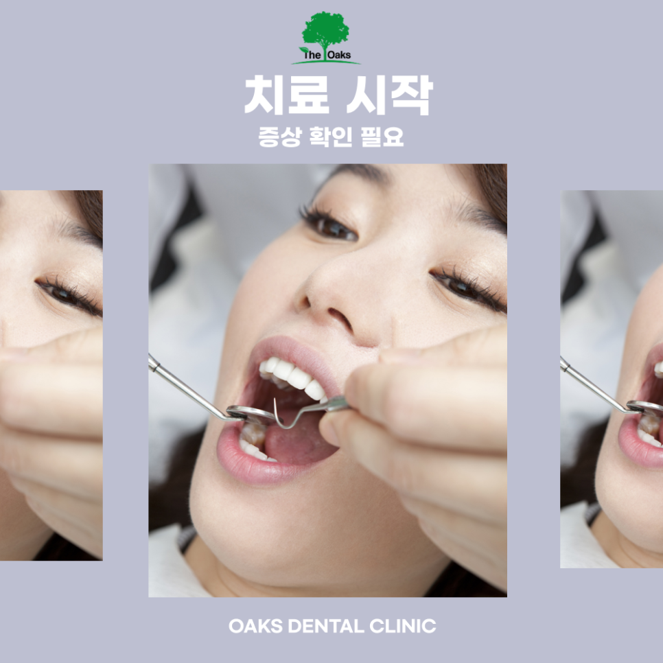 세곡동치과 치주염치료 잇몸 건강을 되찾는 과정 관련 이미지 2