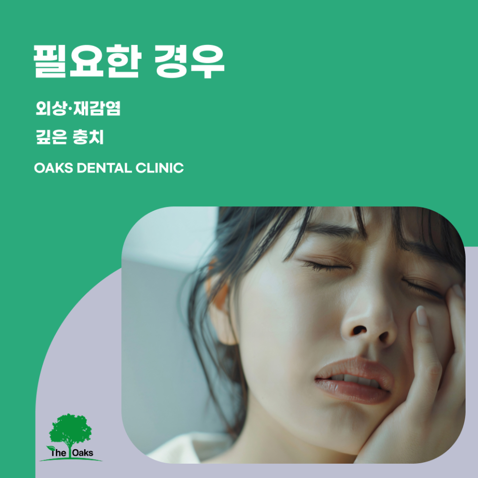 대치동치과 신경치료 치아를 살리기 위한 마지막 선택이 아닌 필수적인 치료 관련 이미지 2