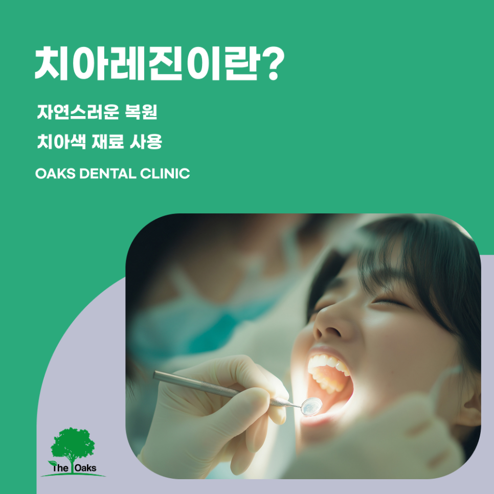 서초역치과 치아레진 자연스럽게 복원하는 방법 장점과 주의사항까지 관련 이미지 1