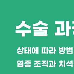 대치동치과 치주수술 어떤 경우에 필요할까요? 관련 이미지 8