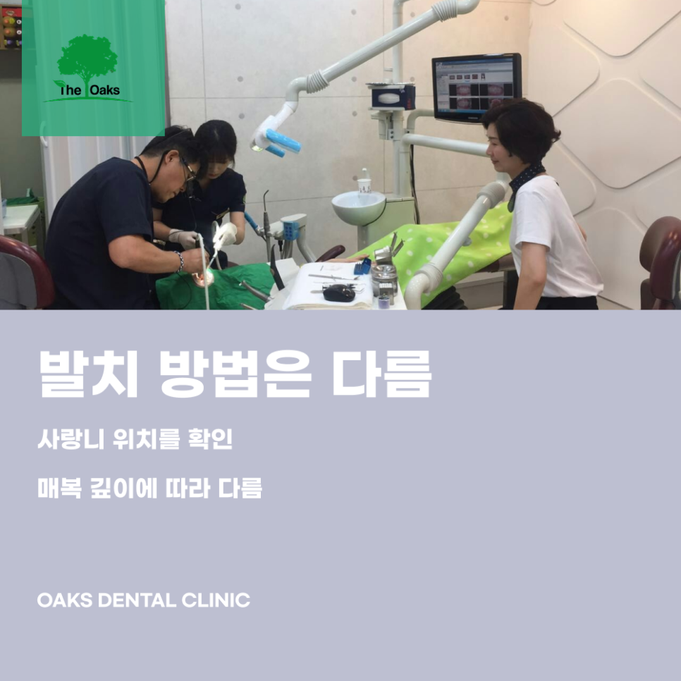 청담동치과 매복사랑니는 왜 발치할까요? 관련 이미지 3