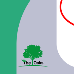 신사동치과 어금니임플란트 저작 기능 회복을 위한 안정적인 선택 관련 이미지 14