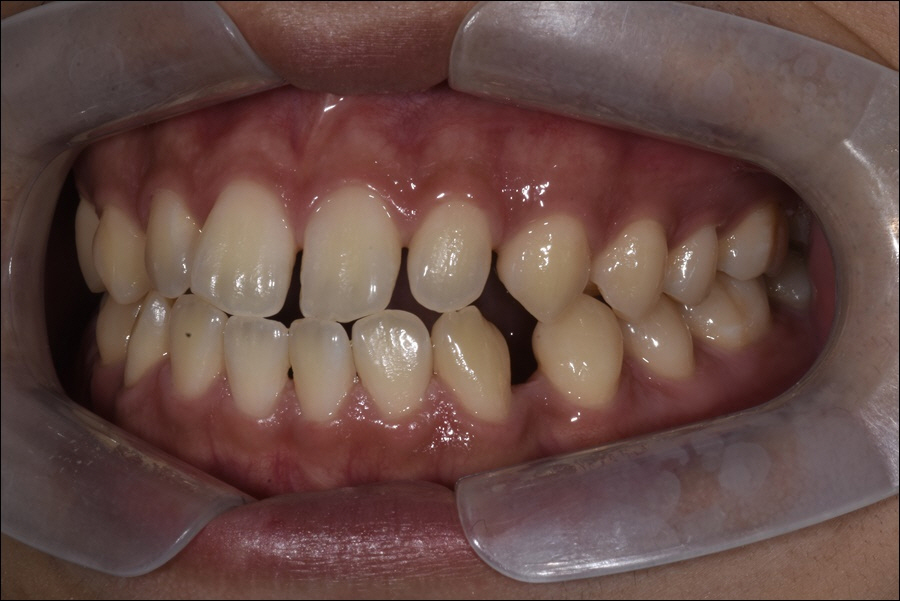 신논현치과 치아 건강을 위하여 관련 이미지 3