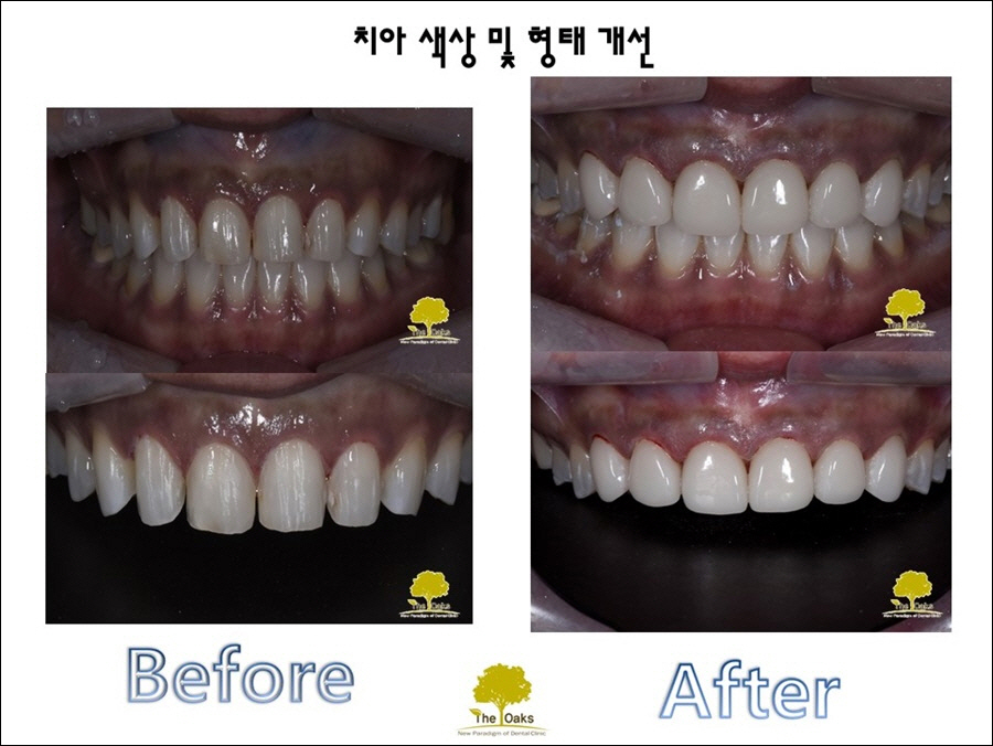 강남라미네이트 최소한의 삭제 관련 이미지 2