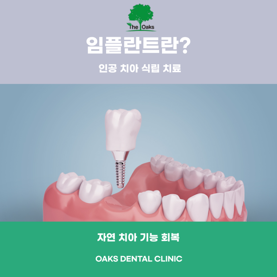 개포동치과 임플란트 과정 처음부터 끝까지 꼼꼼히 알아보자 관련 이미지 1