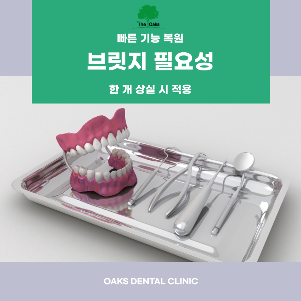 대치동치과 치아브릿지 어떤 상황에 도움될까 관련 이미지 2