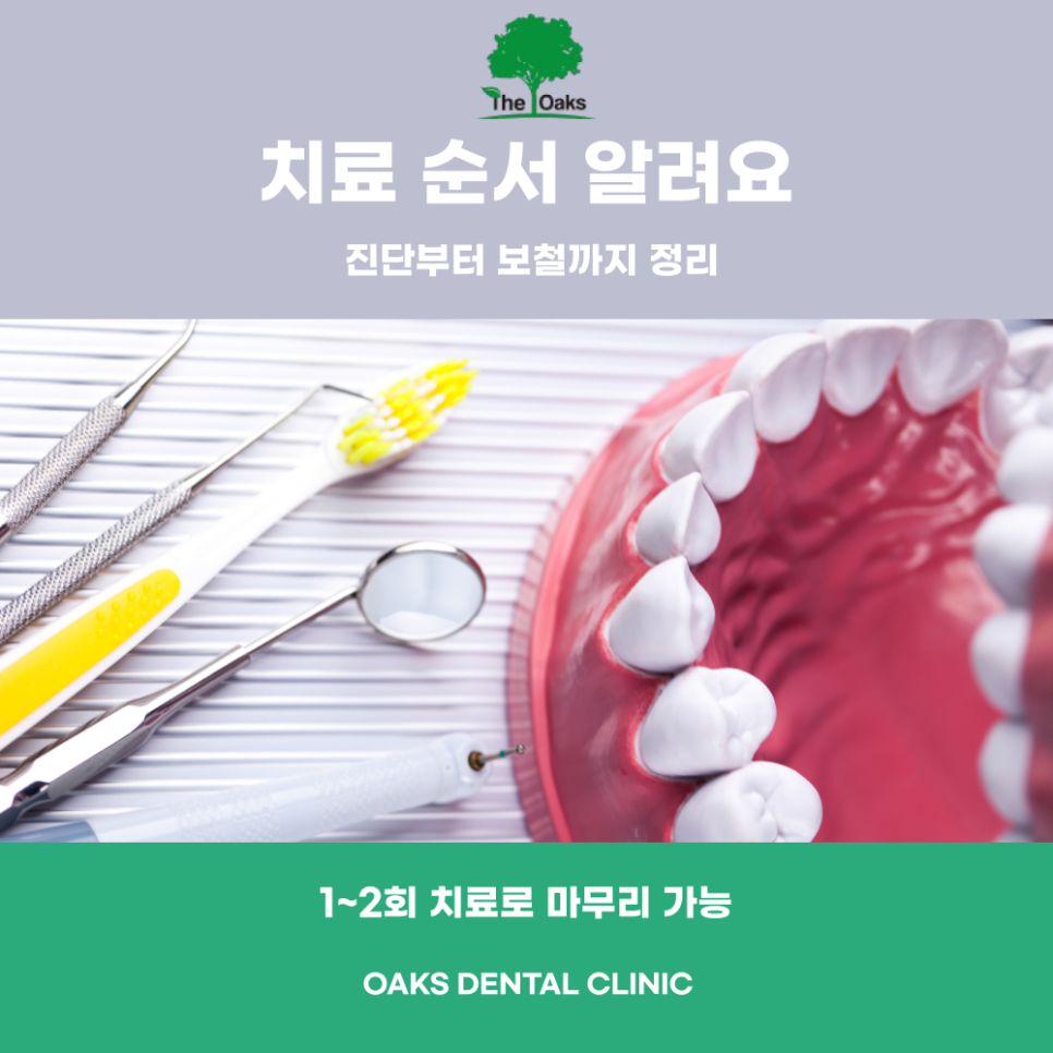 세곡동치과 앞니신경치료 꼭 필요한 이유와 치료 과정 안내 관련 이미지 3