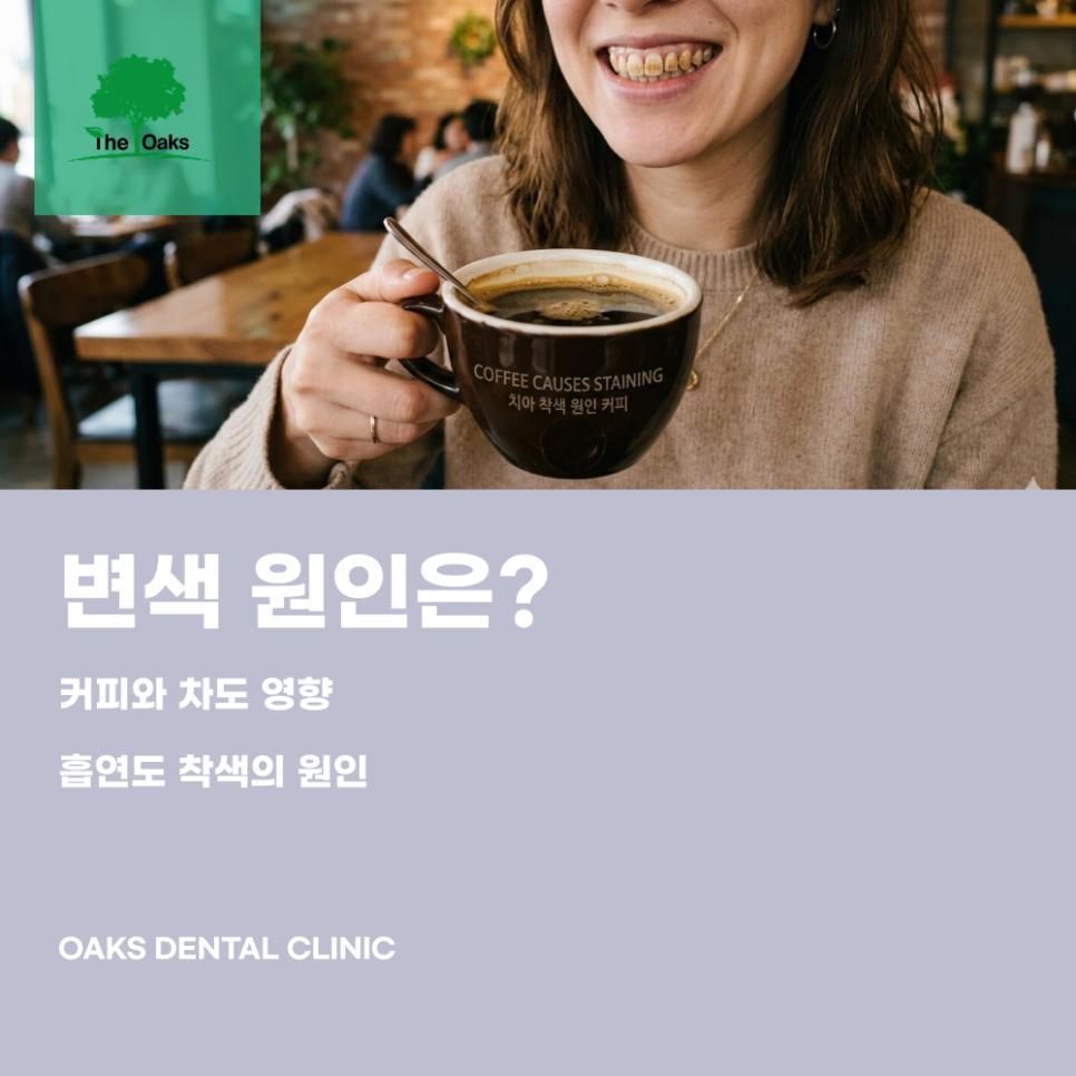 Daechi-dong Dental Clinic: Teeth Whitening Effects and Process, Helpful Information to Know Before Treatment image 2