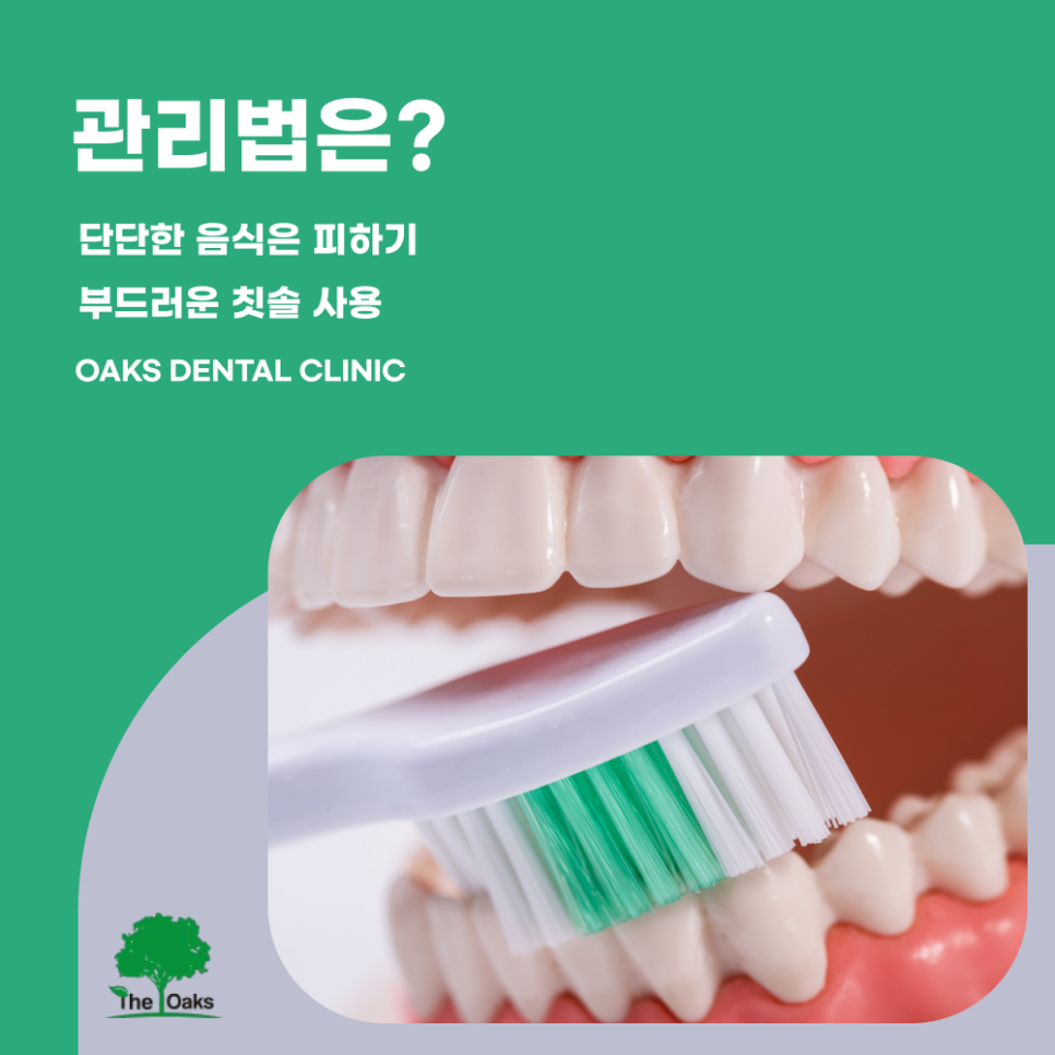 강남치과 라이네이트 장단점 알아보자 관련 이미지 5