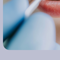 역삼동치과 잇몸고름주머니 방치하면 위험한 이유 원인부터 치료까지 관련 이미지 15