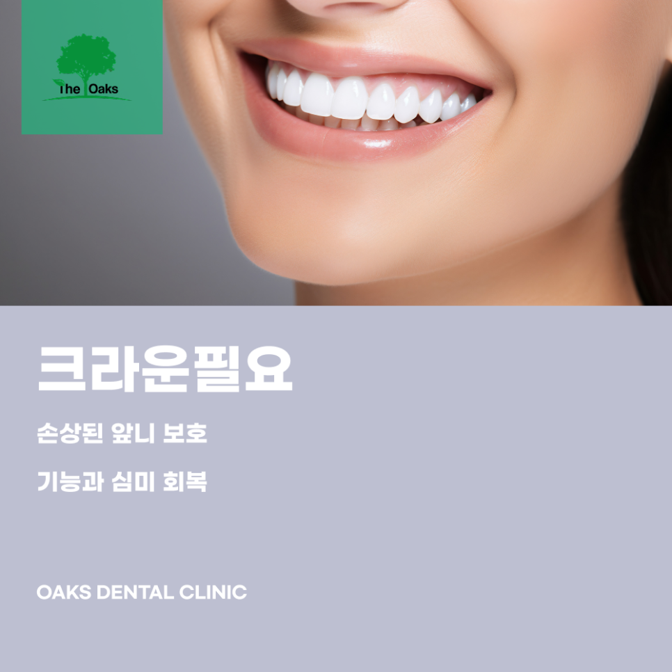 개포동치과 앞니크라운 자연스러운 미소를 되찾는 방법 관련 이미지 1