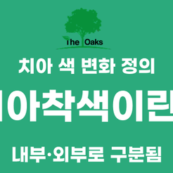 신사동치과 치아착색 원인부터 깨끗하게 되돌리는 방법까지 관련 이미지 9