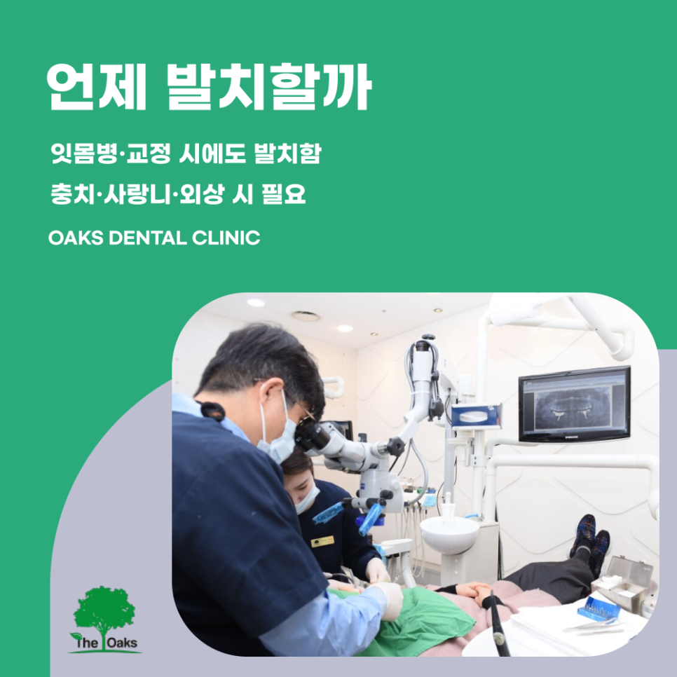대치동치과 발치 언제 필요할까 관련 이미지 1