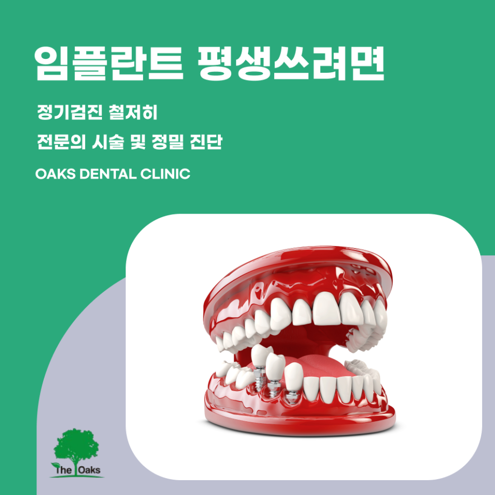 도곡동치과 임플란트수명은 얼마나 될까 관련 이미지 5