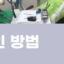 Key Information to Know Before Undergoing Cosmetic Dental Treatment at a Seocho Station Dental Clinic image 12