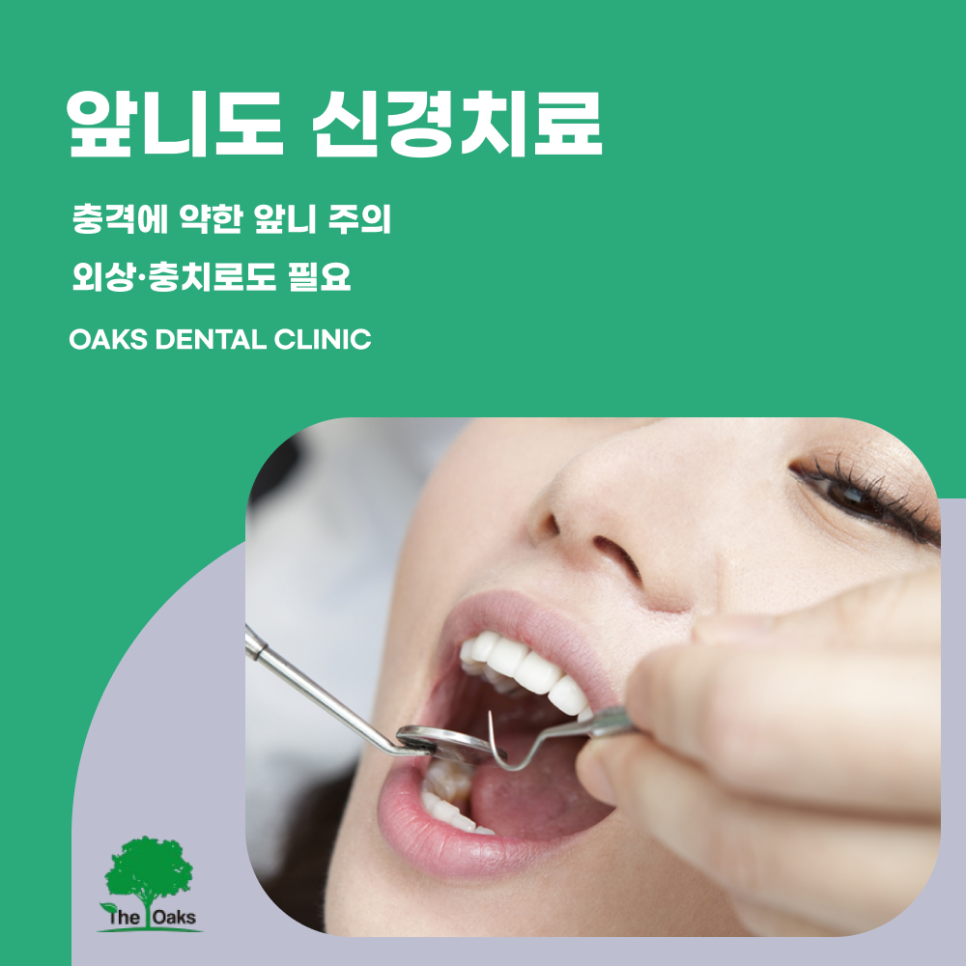 세곡동치과 앞니신경치료 꼭 필요한 이유와 치료 과정 안내 관련 이미지 1