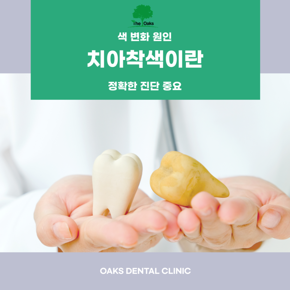 자곡동치과 치아착색 원인부터 개선 방법까지 알아보세요 관련 이미지 1