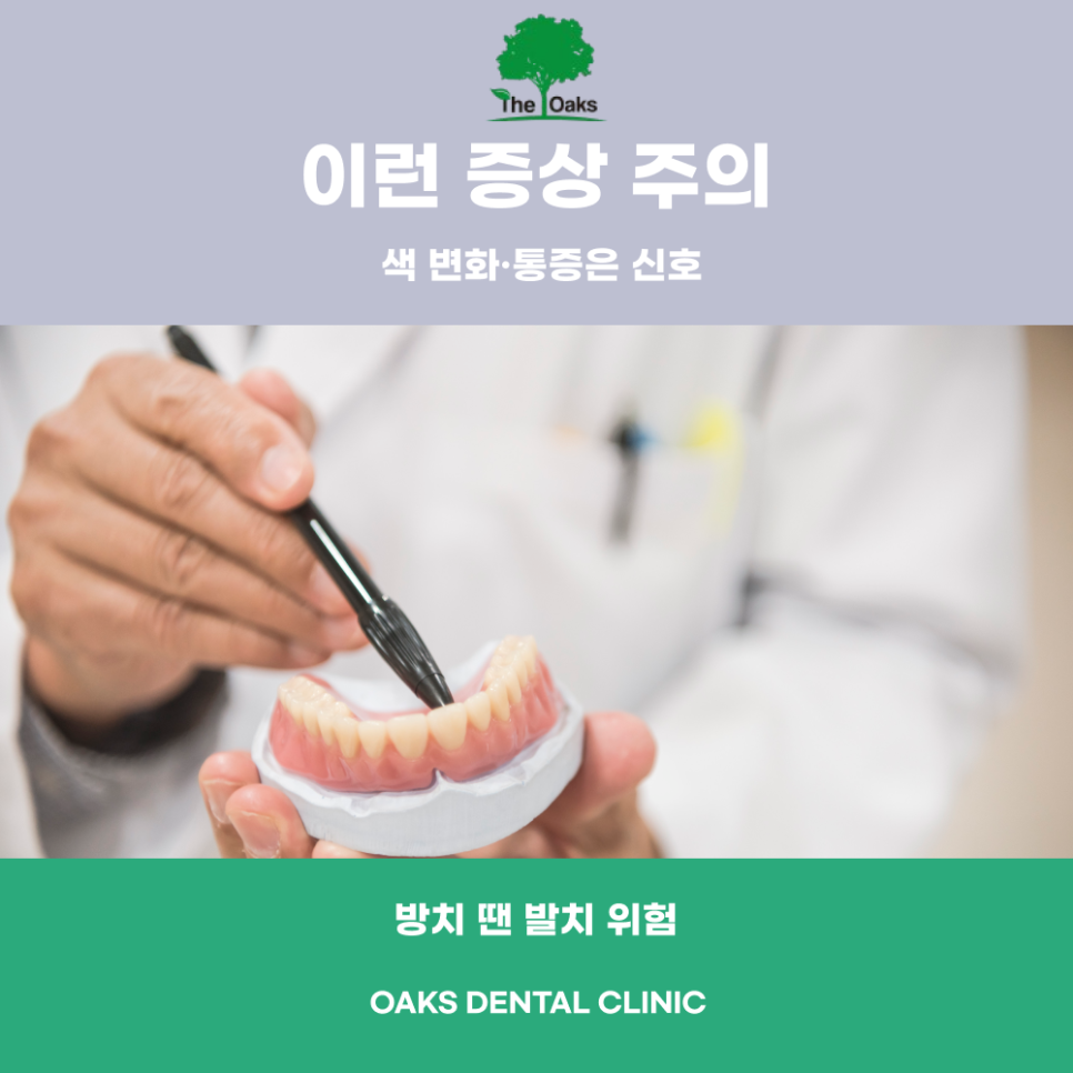 세곡동치과 앞니신경치료 꼭 필요한 이유와 치료 과정 안내 관련 이미지 2