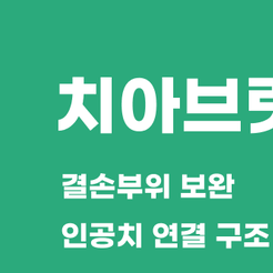 강남치과 치아브릿지 빠르고 안정적인 결손치 치료 방법 관련 이미지 8