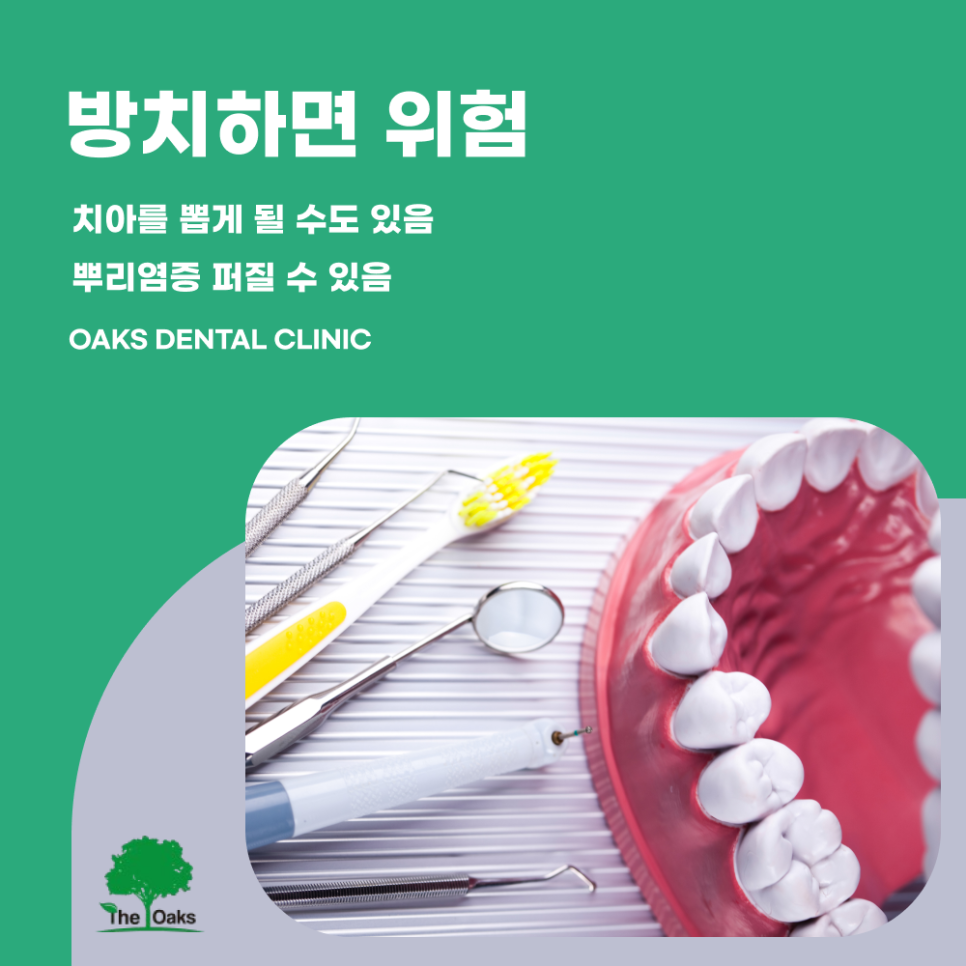 청담동치과 신경치료 아픈 치아를 살리는 마지막 방법 관련 이미지 5