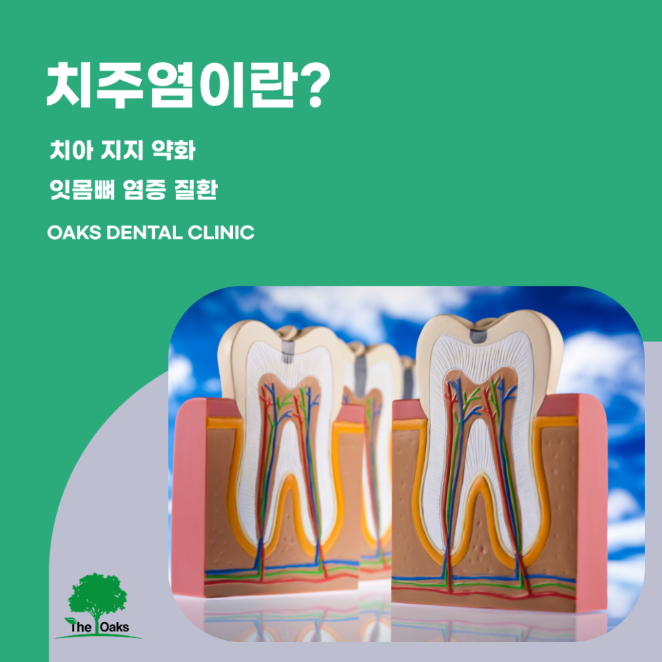 Samseong-dong Dental Clinic: Problems Caused by Ignoring Periodontitis and How to Manage It image 1