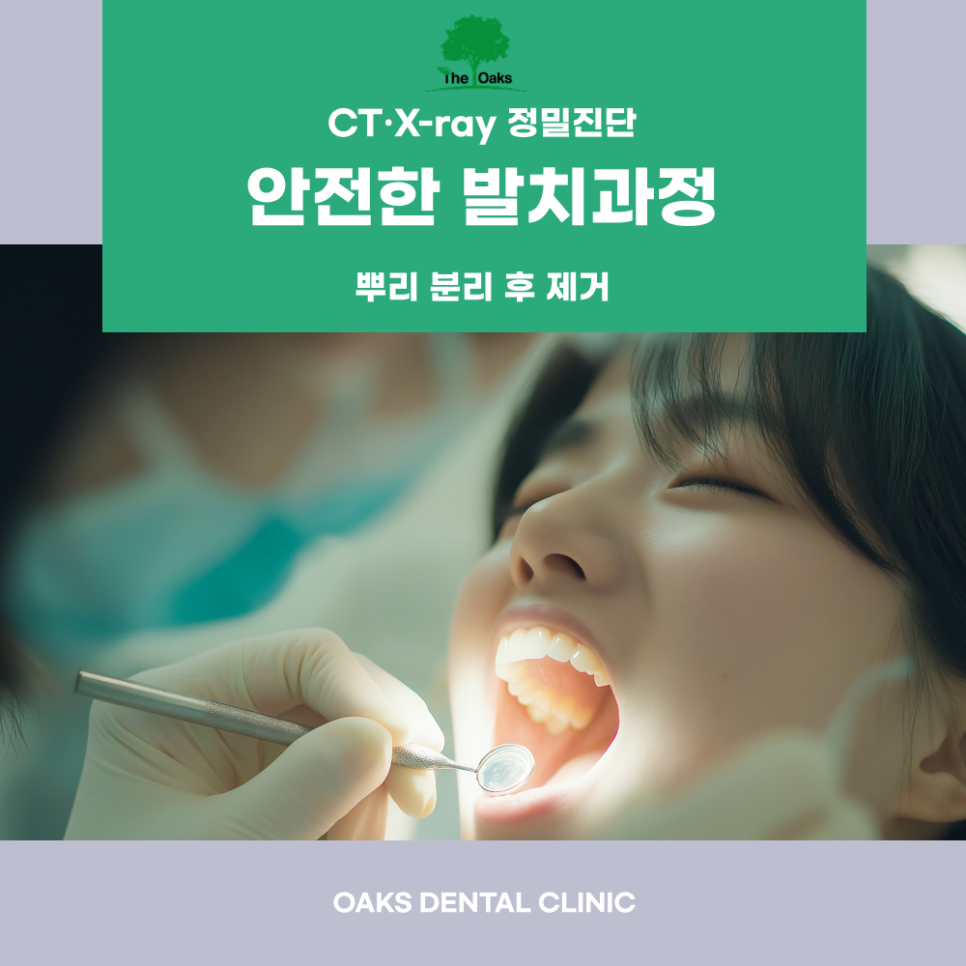 청담동치과 어금니발치 꼭 필요할 때만 선택하는 신중한 치료 이야기 관련 이미지 3