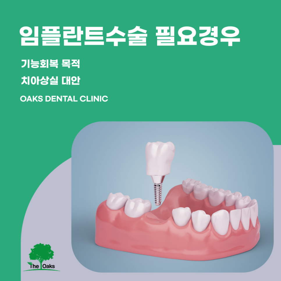 삼성동치과 임플란트수술 과정과 회복까지 제대로 이해해야 하는 이유 관련 이미지 1