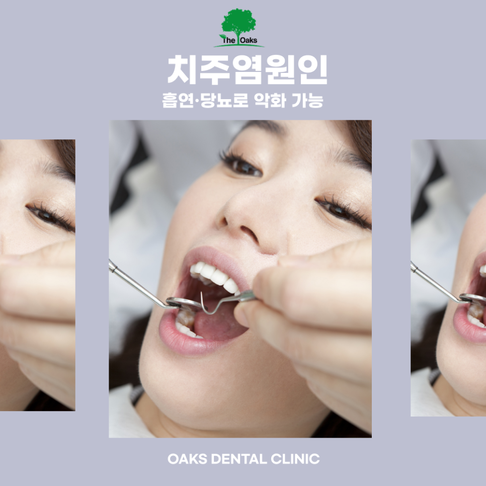 자곡동치과 치주염치료 잇몸 속 염증부터 잡아야 건강이 회복됩니다 관련 이미지 2